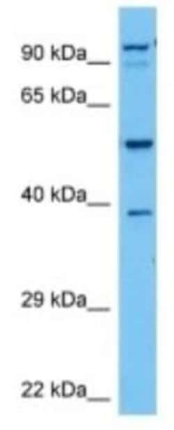 CYP3A25 Rabbit anti-Mouse, Polyclonal, Novus Biologicals 100 &mu;g | Buy Online | Novus Biologicals | Fisher Scientific